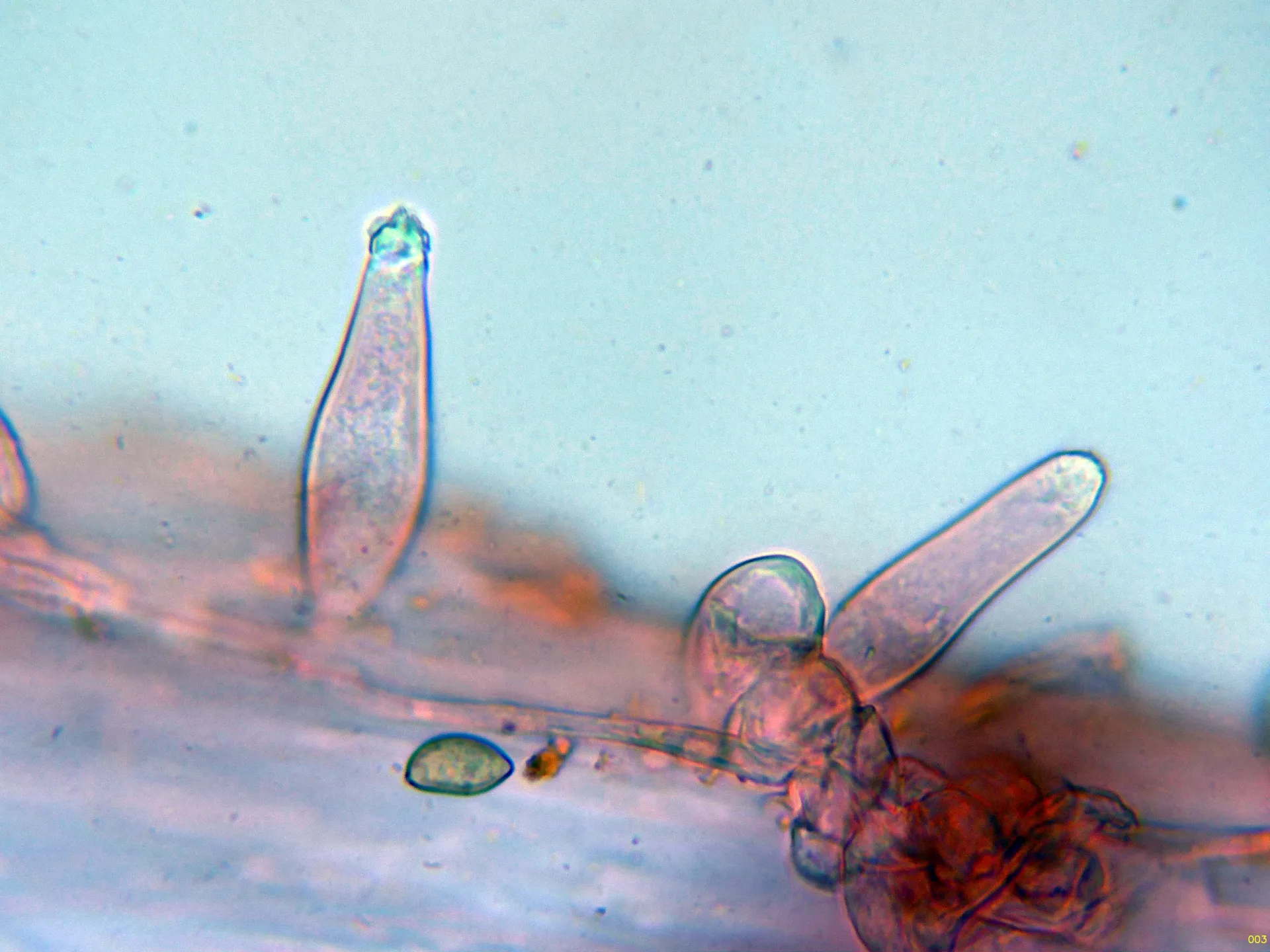 Microscopía de Inocybe helobia - 10 - Caulos alto-003